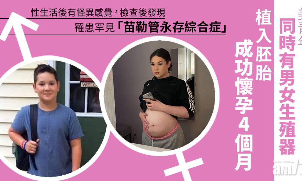 美青年同時有男女生殖器 植入胚胎成功懷孕4個月
