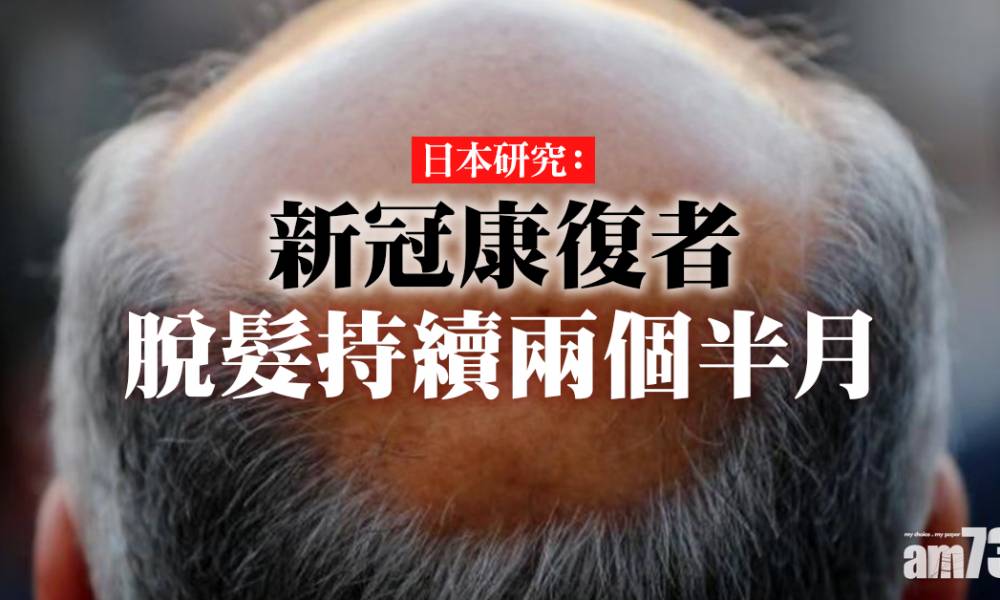  【新冠肺炎】日本研究：新冠康復者脫髮持續兩個半月