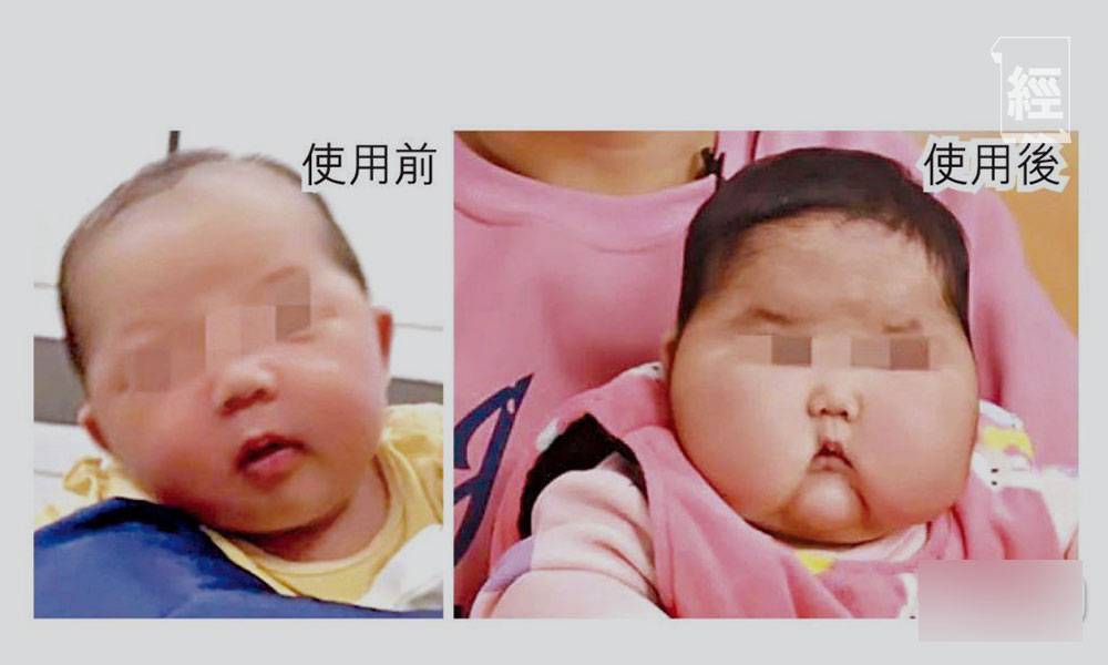  內地現「大頭娃娃」 兩款嬰兒抑菌霜證含激素 微博網民：關鍵監督監管在哪裡