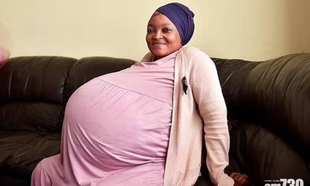 紀錄有待查證｜南非女子報稱剖腹誕10胞胎 丈夫：得7男3女很激動