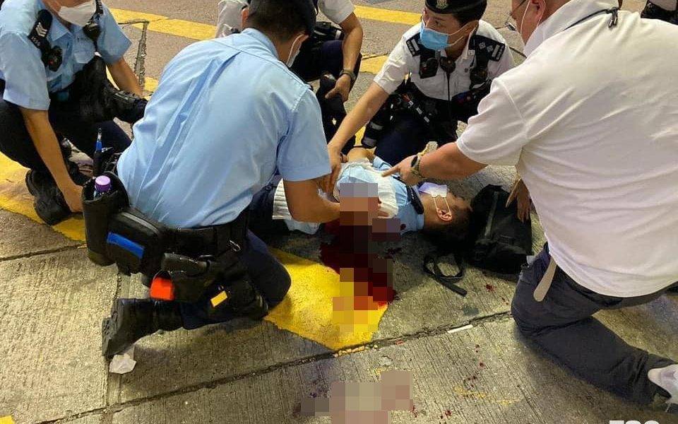  銅鑼灣遇襲男警中刀傷及肺情況嚴重　鄧炳強：孤狼式恐怖襲擊