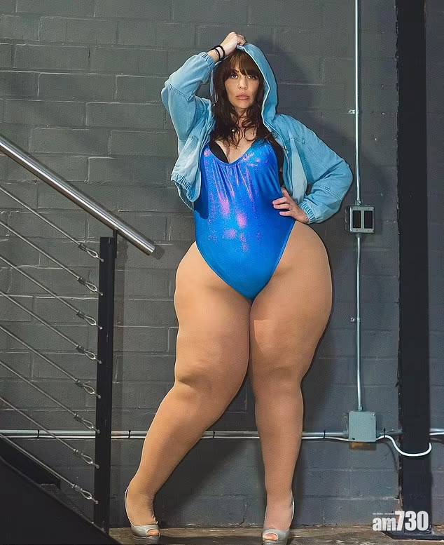 大碼模特兒｜美婦節食圖減34吋巨腿 原來患病下身囤積脂肪