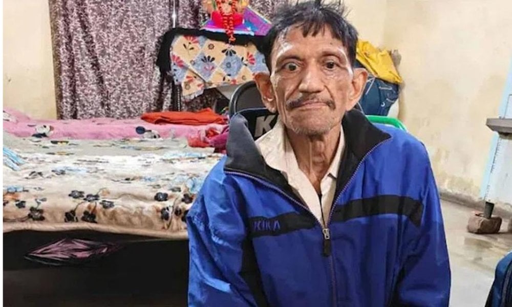 印度痲瘋男「靜坐式」行乞 默默放高利貸暴利賺息？例行救援行動揭發真相：手揸3座豪宅、出租車 仲獲派政府廉租屋