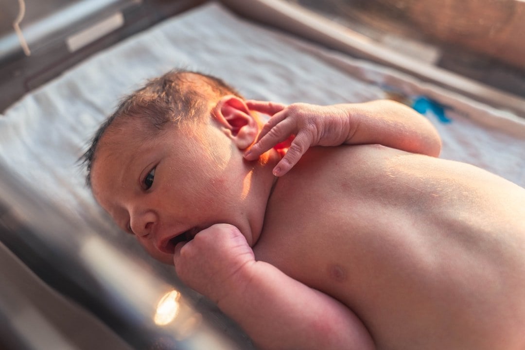自願醫保先天性疾病保障 初生嬰兒