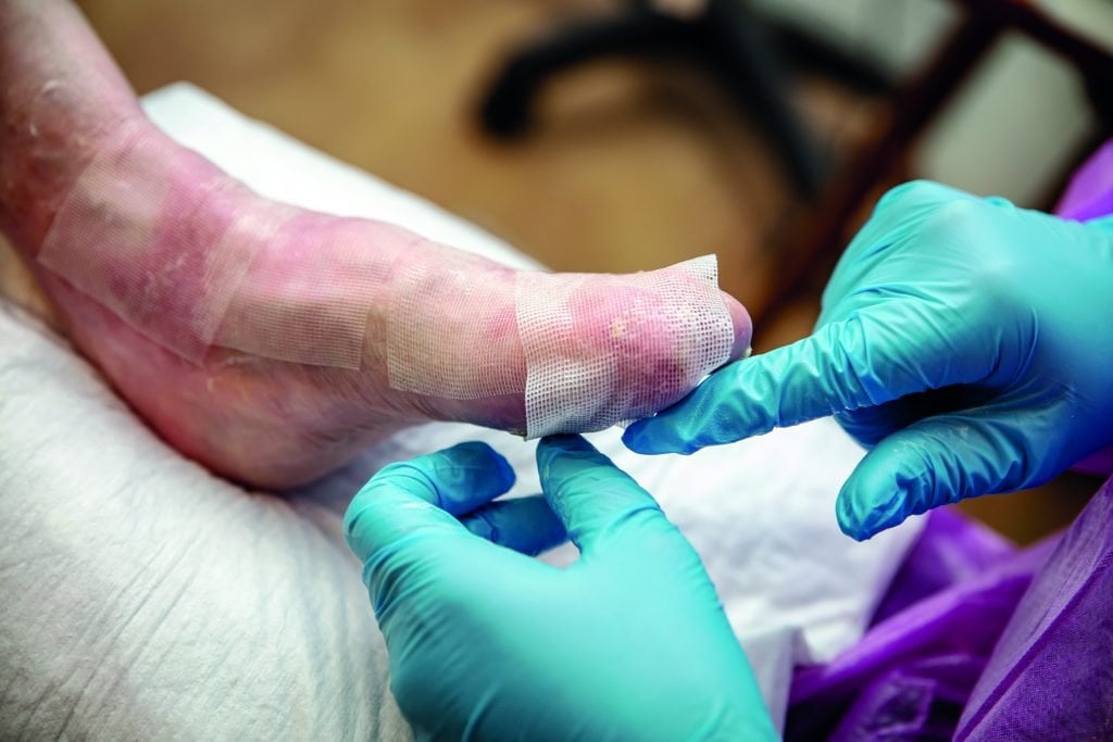 most rare Rare Ventures is extending the “ venture philanthropy ” model of the EB Research Partnership, a New York-based nonprofit that funds research into treatments for epidermolysis bullosa, a group of genetic diseases that give the skin a papery quality prone to blistering. (圖片來源:iStock photo)