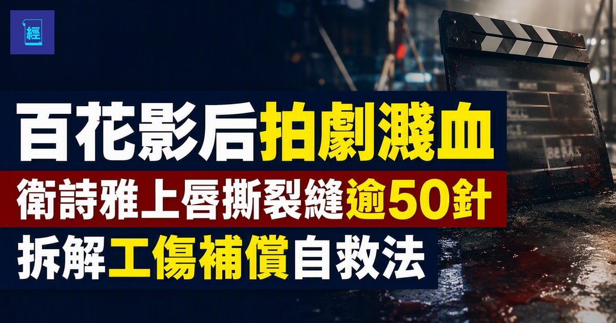 【百花影后拍劇濺血】衛詩雅上唇撕裂縫逾50針　自揭滿口玻璃以為甩牙　拆解工傷補償自救法